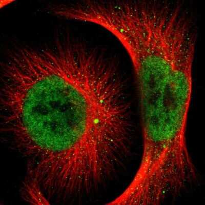 Immunocytochemistry/ Immunofluorescence: NCOA6 Antibody [NBP1-89193]