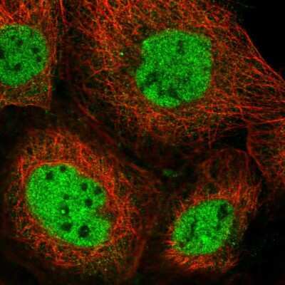 Immunocytochemistry/ Immunofluorescence: NCOA6 Antibody [NBP2-55622]