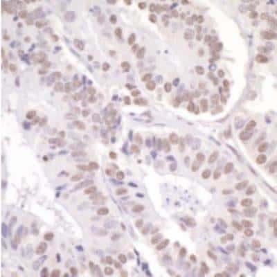 Immunohistochemistry-Paraffin: NCOA6 Antibody [NB200-335]