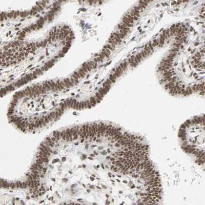 Immunohistochemistry-Paraffin: NCOA6 Antibody [NBP1-89193]