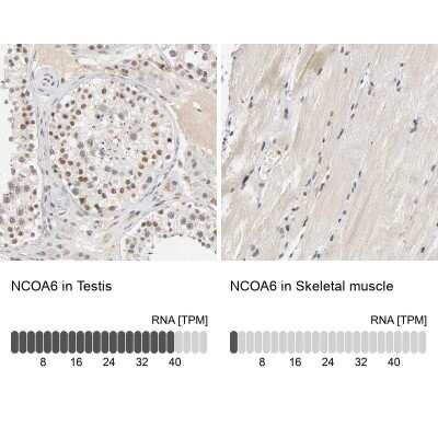 Immunohistochemistry-Paraffin: NCOA6 Antibody [NBP1-89193]