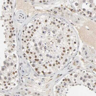 Immunohistochemistry-Paraffin: NCOA6 Antibody [NBP1-89193]