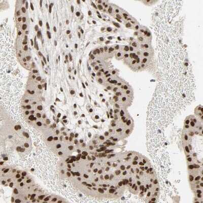 Immunohistochemistry-Paraffin: NCOA6 Antibody [NBP1-89193]