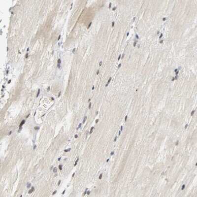 Immunohistochemistry-Paraffin: NCOA6 Antibody [NBP1-89193]
