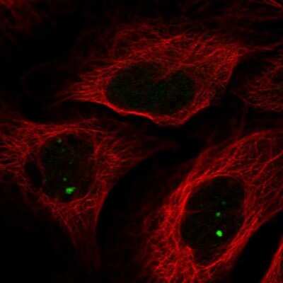 Immunocytochemistry/ Immunofluorescence: NCOA7 Antibody [NBP1-85199]