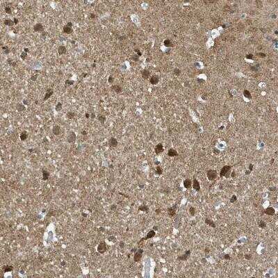 Immunohistochemistry-Paraffin: NCOA7 Antibody [NBP1-85202]