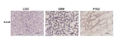 Immunohistochemistry: NCOR1 Antibody (7A7A9) - BSA Free [NBP1-28863]