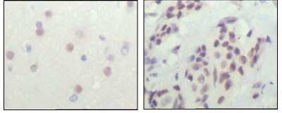 Immunohistochemistry-Paraffin: NCOR1 Antibody (7A7A9) - BSA Free [NBP1-28863]