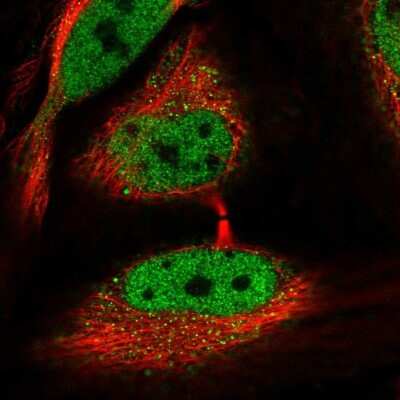 Immunocytochemistry/ Immunofluorescence: NCOR1 Antibody [NBP2-48997]