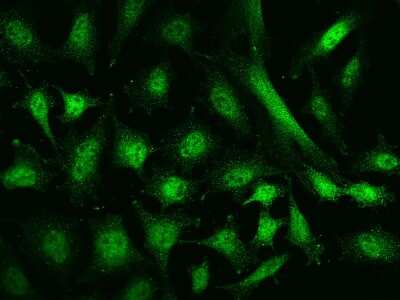 Immunocytochemistry/ Immunofluorescence: NCOR1 Antibody [NBP2-97461]