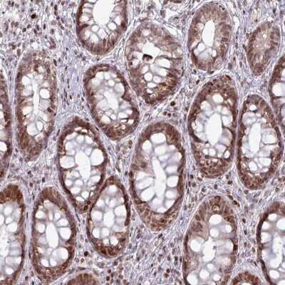 Immunohistochemistry: NCOR1 Antibody [NBP2-48997]