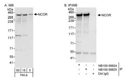 Immunoprecipitation: NCOR1 Antibody [NB100-58824]