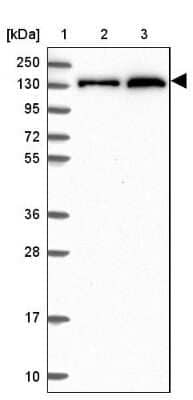 Western Blot: NCOR1 Antibody [NBP2-47360]