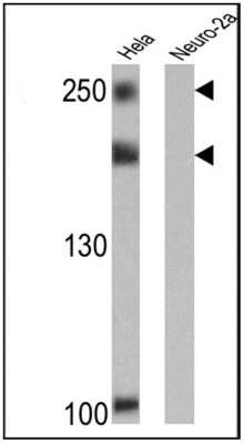 Western Blot: NCOR2 Antibody (1542) [NB120-2781]