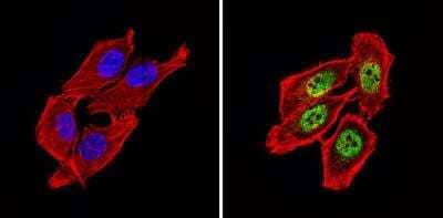 Immunocytochemistry/ Immunofluorescence: NCOR2 Antibody [NB120-5802]