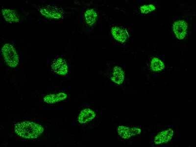 Immunocytochemistry/ Immunofluorescence: NCOR2 Antibody [NBP2-98866]