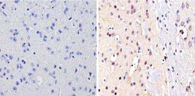Immunohistochemistry-Paraffin: NCOR2 Antibody [NB120-5802]