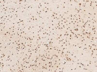 Immunohistochemistry-Paraffin: NCOR2 Antibody [NBP2-98866]