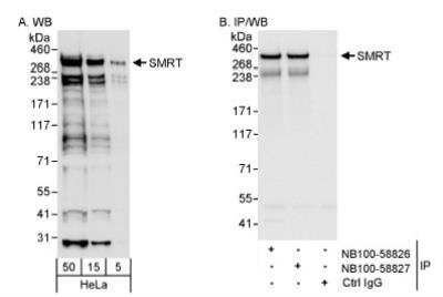 Western Blot: NCOR2 Antibody [NB100-58826]