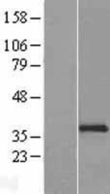 Western Blot: NKp46/NCR1 Overexpression Lysate [NBL1-13519]