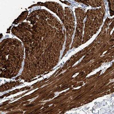 Immunohistochemistry-Paraffin: NCU-G1 Antibody [NBP1-93491]