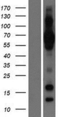 Western Blot: NCU-G1 Overexpression Lysate [NBP2-05563]