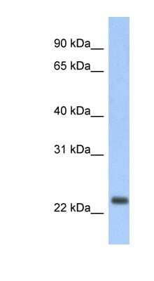 Western Blot: ND6 Antibody [NBP1-70650]