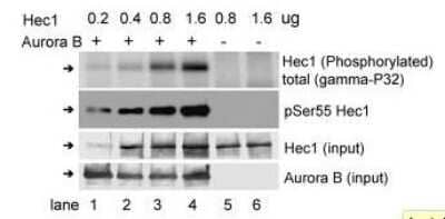 Western Blot: NDC80 [p Ser55] Antibody [NBP3-13726]