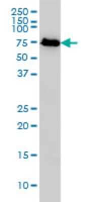 Western Blot: NDC80 Antibody (1A10) [H00010403-M01]