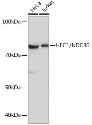 Western Blot: NDC80 Antibody (4W2Y2) [NBP3-16121]