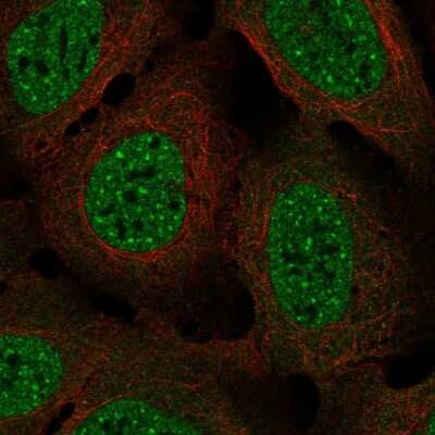 Immunocytochemistry/ Immunofluorescence: NDC80 Antibody [NBP2-56920]