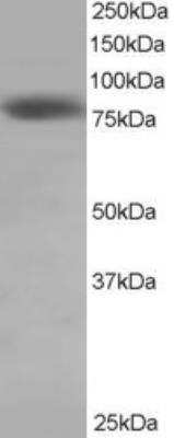 Western Blot: NDC80 Antibody [NB100-1100]