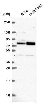 Western Blot: NDC80 Antibody [NBP2-56920]