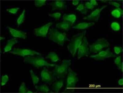 Immunocytochemistry/ Immunofluorescence: NDE1 Antibody (2G11-1C11) [H00054820-M01]