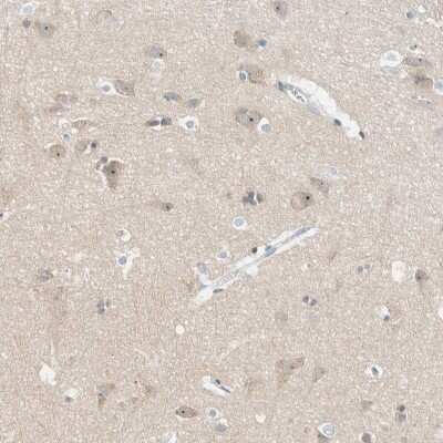 Immunohistochemistry-Paraffin: NDE1 Antibody [NBP1-83671]
