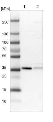 Western Blot: NDE1 Antibody [NBP1-83671]