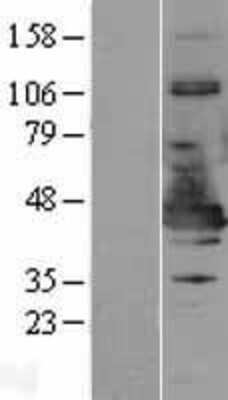 Western Blot: NDE1 Overexpression Lysate [NBL1-13522]