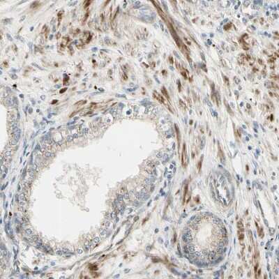 Immunohistochemistry-Paraffin: NDFIP1 Antibody [NBP1-81234]