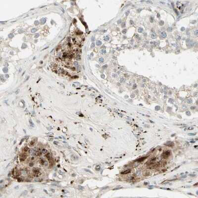 Immunohistochemistry-Paraffin: NDFIP1 Antibody [NBP1-81234]