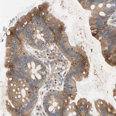 Immunohistochemistry-Paraffin: NDFIP2 Antibody [NBP1-81436]
