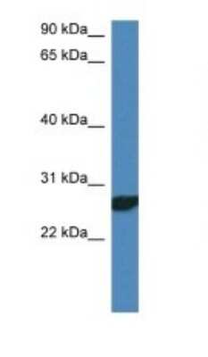 Western Blot: NDFIP2 Antibody [NBP1-74110]