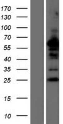 Western Blot: NDFIP2 Overexpression Lysate [NBP2-06725]