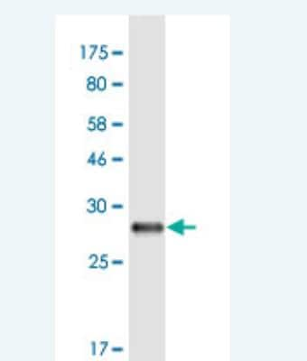 Western Blot: NDNL2 Antibody (4F7) [H00056160-M02-100ug]