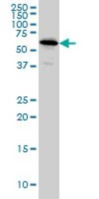 Western Blot: NDOR1 Antibody (3A11) [H00027158-M01]