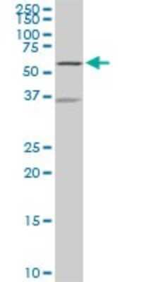 Western Blot: NDOR1 Antibody (3A11) [H00027158-M01]