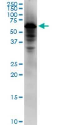 Western Blot: NDOR1 Antibody (5A7) [H00027158-M02]