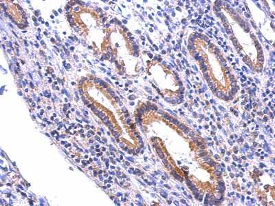 Immunohistochemistry-Paraffin: NDOR1 Antibody [NBP2-19498]