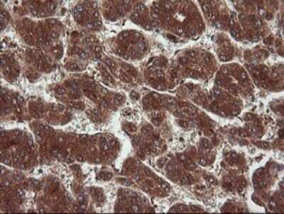 Immunohistochemistry: NDOR1 Antibody (OTI1E3) [NBP2-45856]