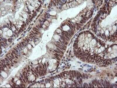Immunohistochemistry: NDOR1 Antibody (OTI1E3) [NBP2-45856]