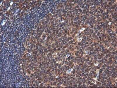 Immunohistochemistry: NDOR1 Antibody (OTI1E3) [NBP2-45856]